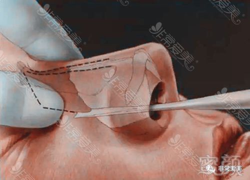 https://img.miyanlife.com/mnt/timg/191029/1213224238-4.jpg