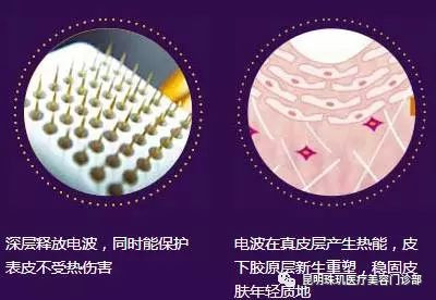 https://img.miyanlife.com/mnt/timg/191029/13001362J-2.jpg