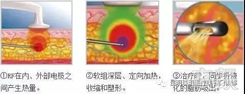 https://img.miyanlife.com/mnt/timg/191029/13001Ib5-8.jpg
