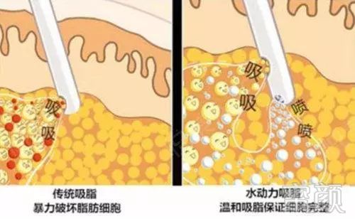 https://img.miyanlife.com/mnt/timg/191029/13024Q055-4.jpg