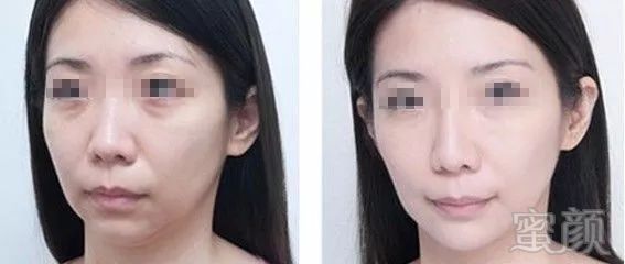 https://img.miyanlife.com/mnt/timg/191029/1303153927-8.jpg
