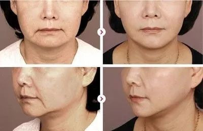 https://img.miyanlife.com/mnt/timg/191029/13031B458-9.jpg