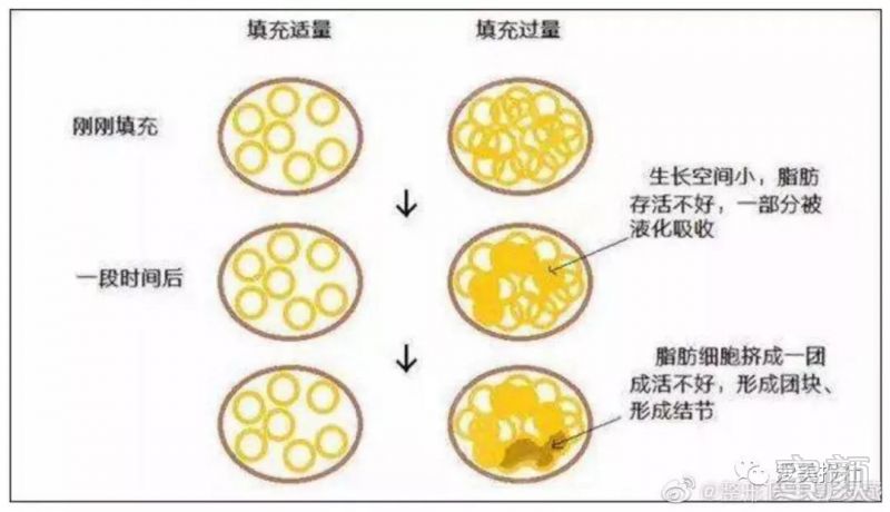 https://img.miyanlife.com/mnt/timg/191029/130345CA-0.jpg