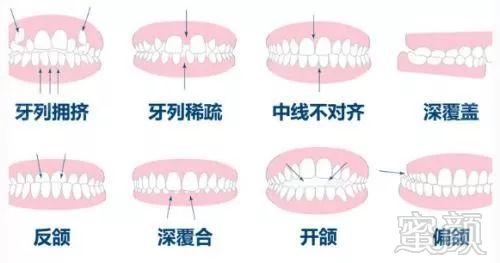 案例图片