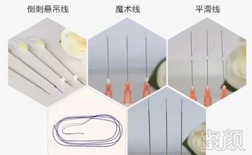 https://img.miyanlife.com/mnt/timg/191029/1413293H3-6.jpg