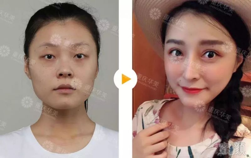 https://img.miyanlife.com/mnt/timg/191030/134F01b6-8.jpg
