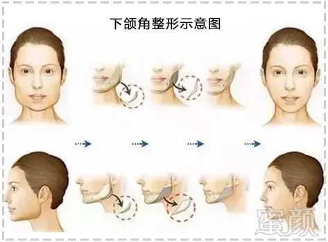 https://img.miyanlife.com/mnt/timg/191030/1350314O5-2.jpg