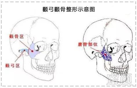https://img.miyanlife.com/mnt/timg/191030/1350315F1-1.jpg