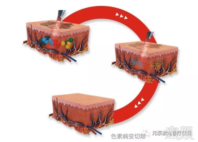 https://img.miyanlife.com/mnt/timg/191030/141HS427-2.jpg