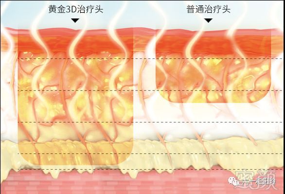 https://img.miyanlife.com/mnt/timg/191030/1442252T6-12.jpg
