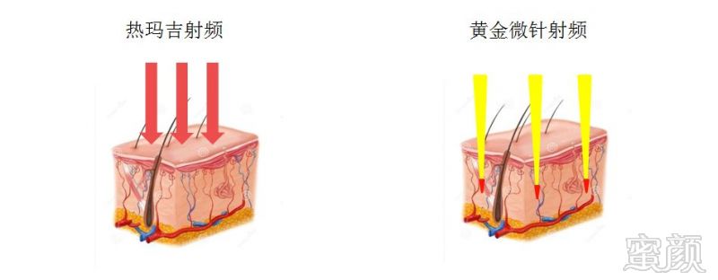 https://img.miyanlife.com/mnt/timg/191031/1313404V8-2.jpg