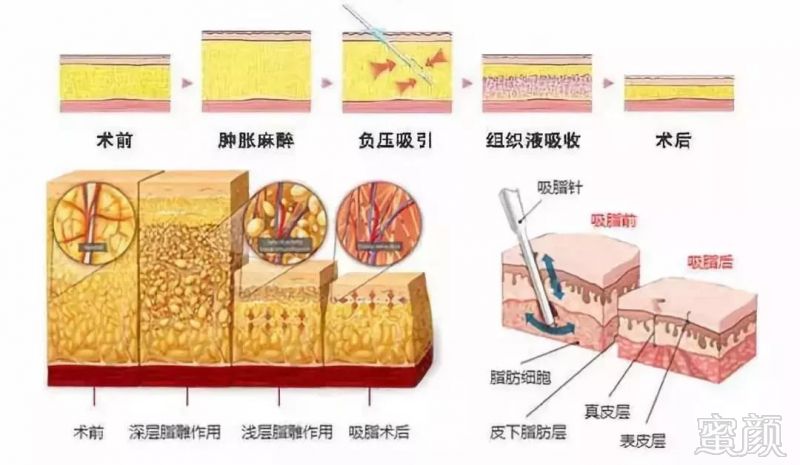 https://img.miyanlife.com/mnt/timg/191031/1342451L8-4.jpg
