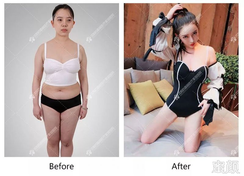 https://img.miyanlife.com/mnt/timg/191031/13424C0T-6.jpg