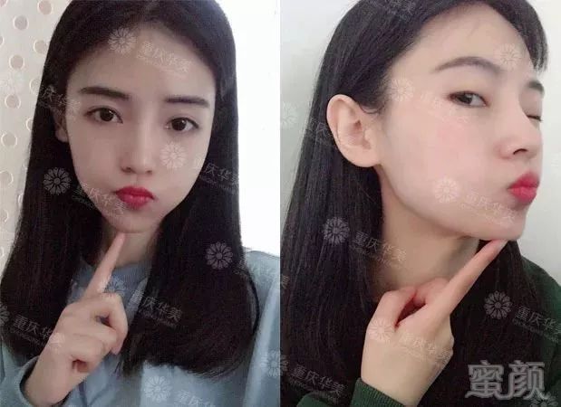 https://img.miyanlife.com/mnt/timg/191101/120000IU-11.jpg