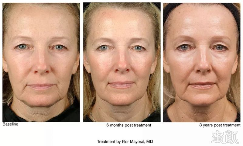 https://img.miyanlife.com/mnt/timg/191101/120211H91-7.jpg