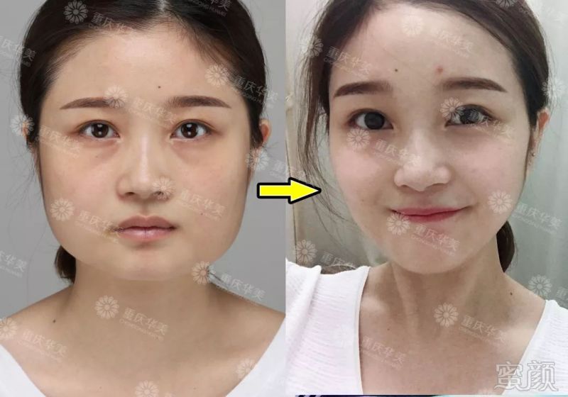 https://img.miyanlife.com/mnt/timg/191101/12050LN6-11.jpg