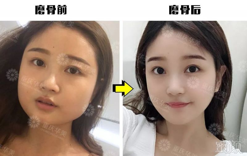 https://img.miyanlife.com/mnt/timg/191101/12050M258-10.jpg