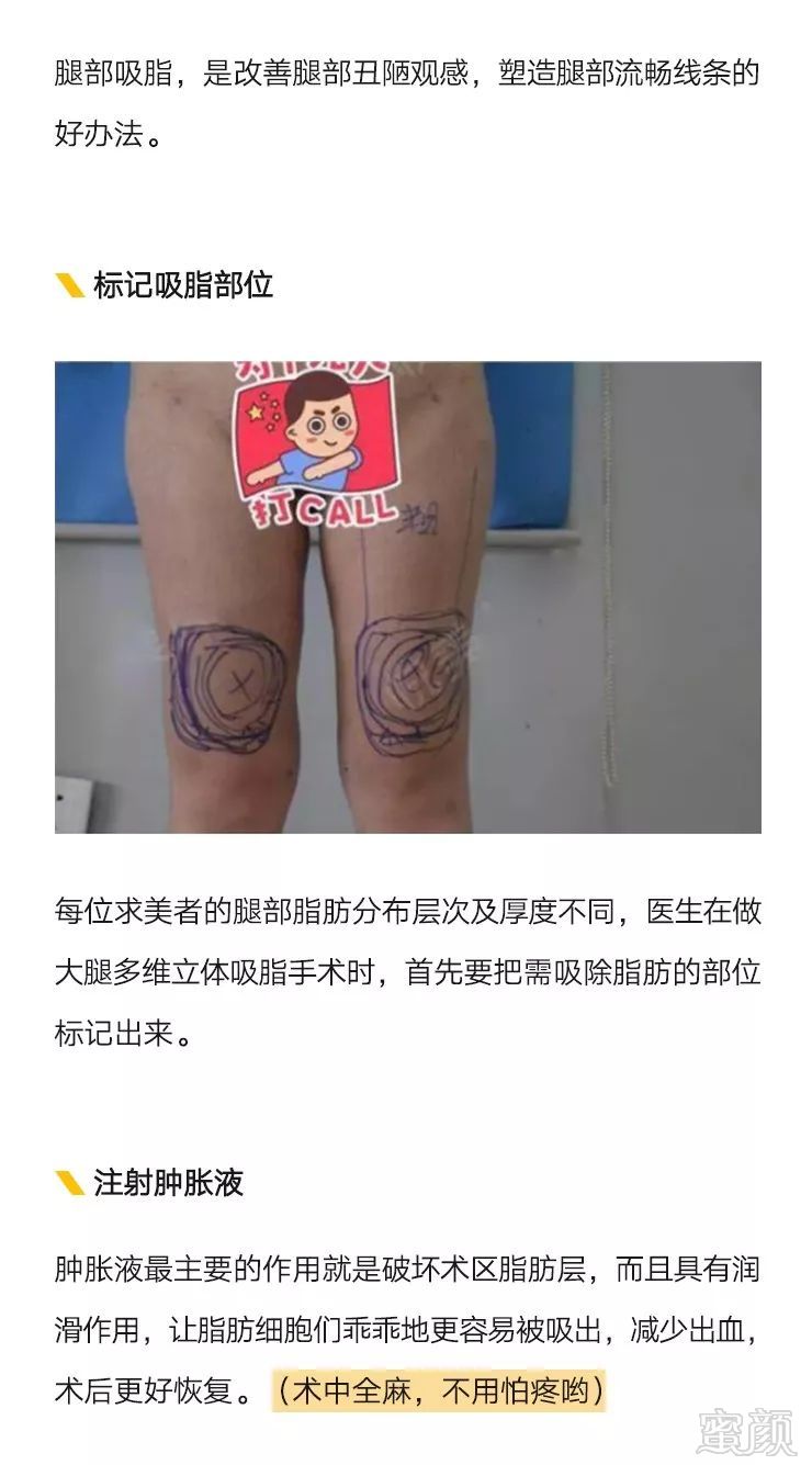 https://img.miyanlife.com/mnt/timg/191101/12135035b-3.jpg
