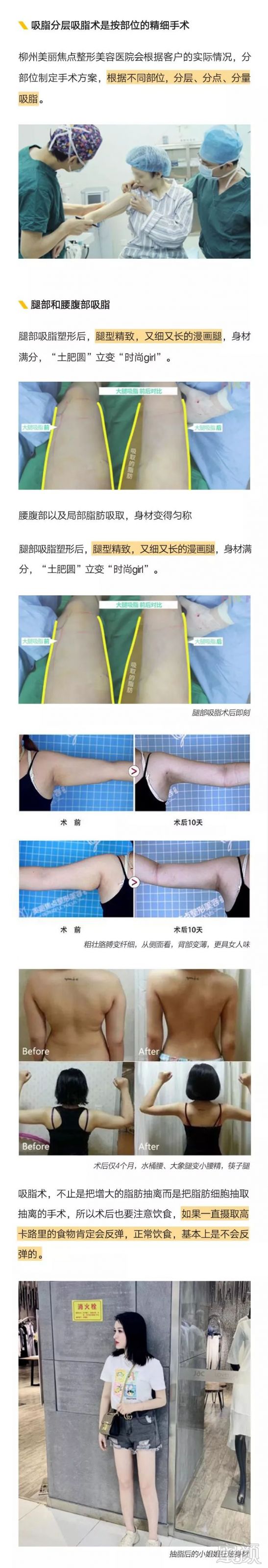 https://img.miyanlife.com/mnt/timg/191101/1214095341-9.jpg