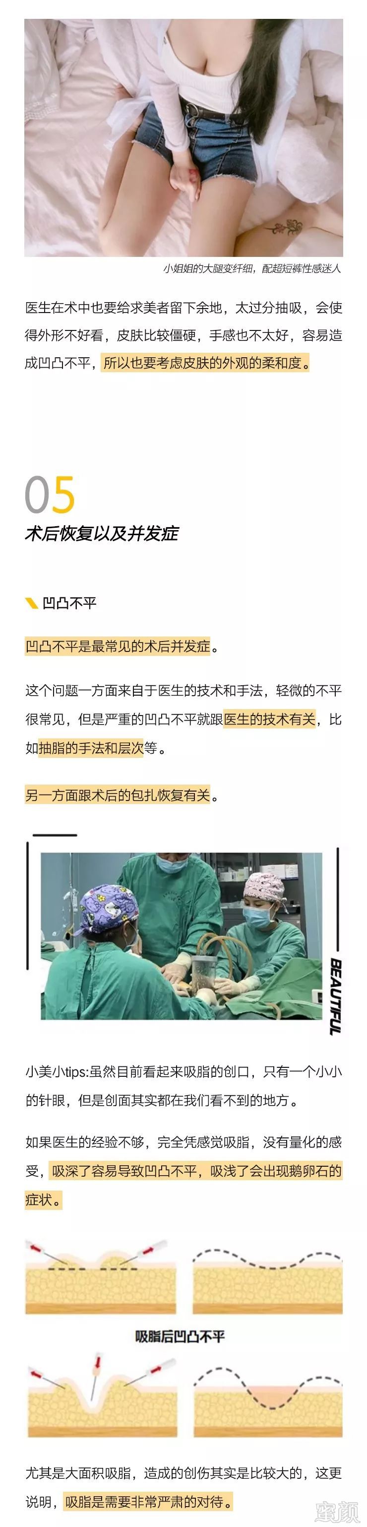https://img.miyanlife.com/mnt/timg/191101/1214111105-10.jpg