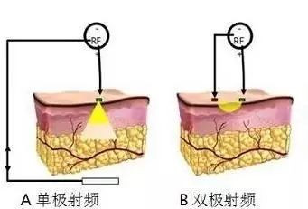 案例图片