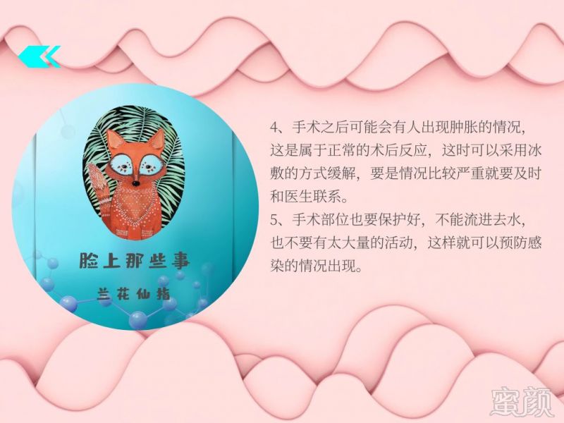 https://img.miyanlife.com/mnt/timg/191103/093J92337-2.jpg