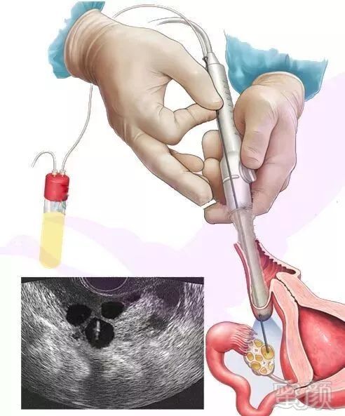 https://img.miyanlife.com/mnt/timg/191103/09452V047-0.jpg