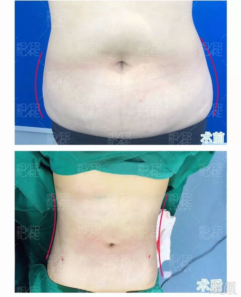 https://img.miyanlife.com/mnt/timg/191103/094ZK1K-2.jpg