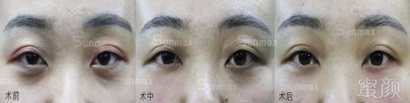 https://img.miyanlife.com/mnt/timg/191103/102GJ4M-13.jpg