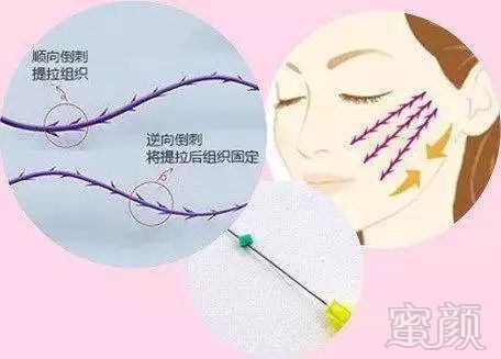 https://img.miyanlife.com/mnt/timg/191103/102GTJ0-14.jpg