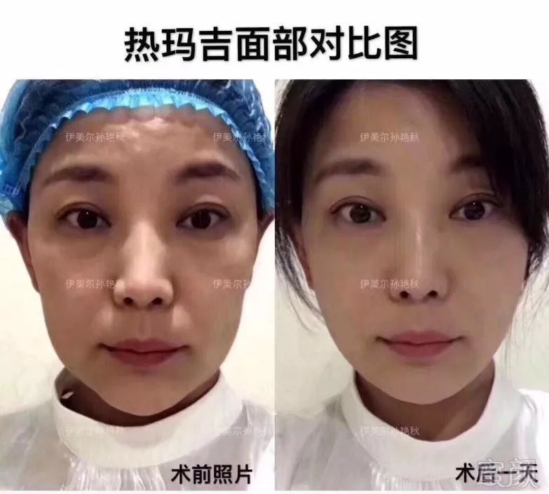 https://img.miyanlife.com/mnt/timg/191104/1239251X2-14.jpg
