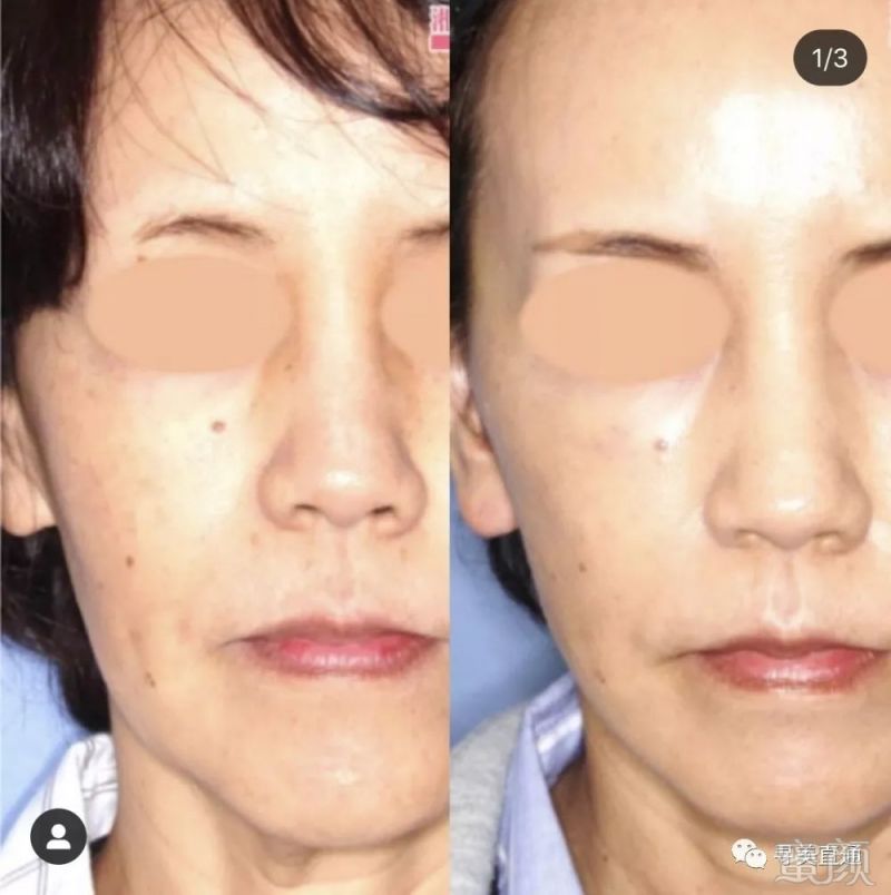 https://img.miyanlife.com/mnt/timg/191106/13361A210-9.jpg