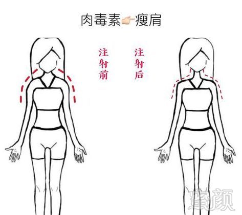 https://img.miyanlife.com/mnt/timg/191107/1251101594-3.jpg