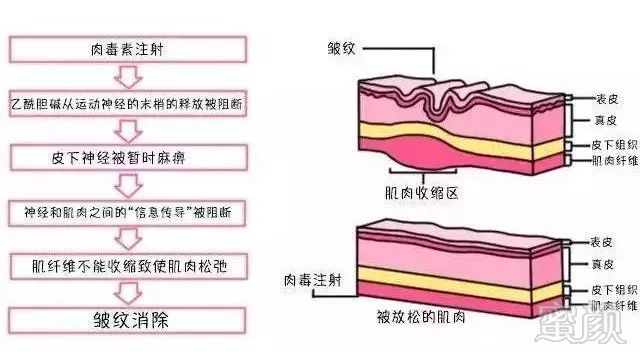 https://img.miyanlife.com/mnt/timg/191107/12511030c-2.jpg