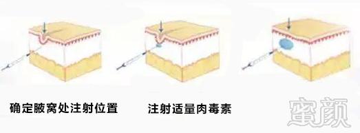https://img.miyanlife.com/mnt/timg/191107/12511131Z-5.jpg