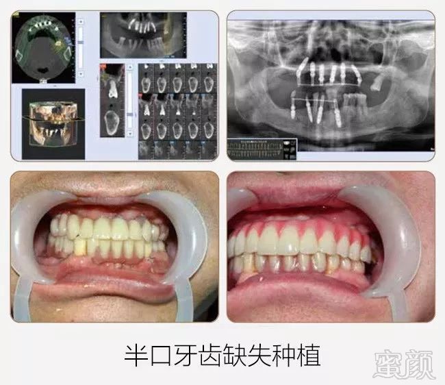 案例图片