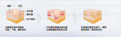 https://img.miyanlife.com/mnt/timg/191107/13223L5L-4.jpg