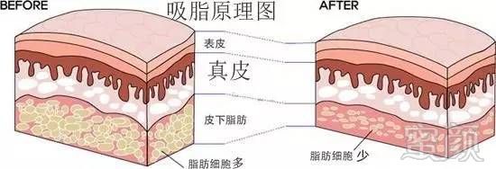 案例图片