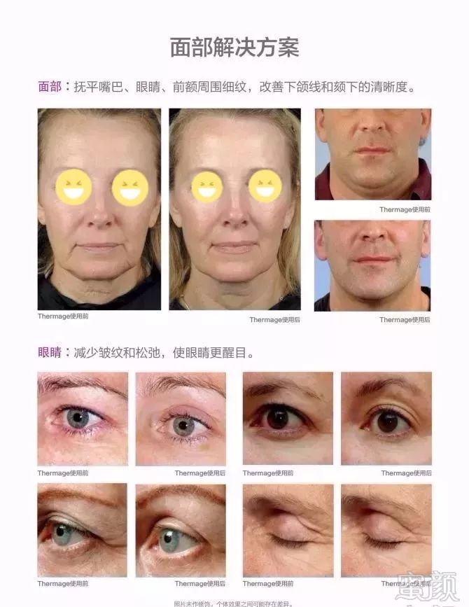 https://img.miyanlife.com/mnt/timg/191108/1051003P9-8.jpg