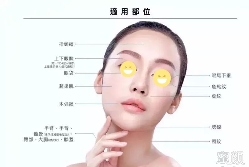 https://img.miyanlife.com/mnt/timg/191108/10510045U-7.jpg