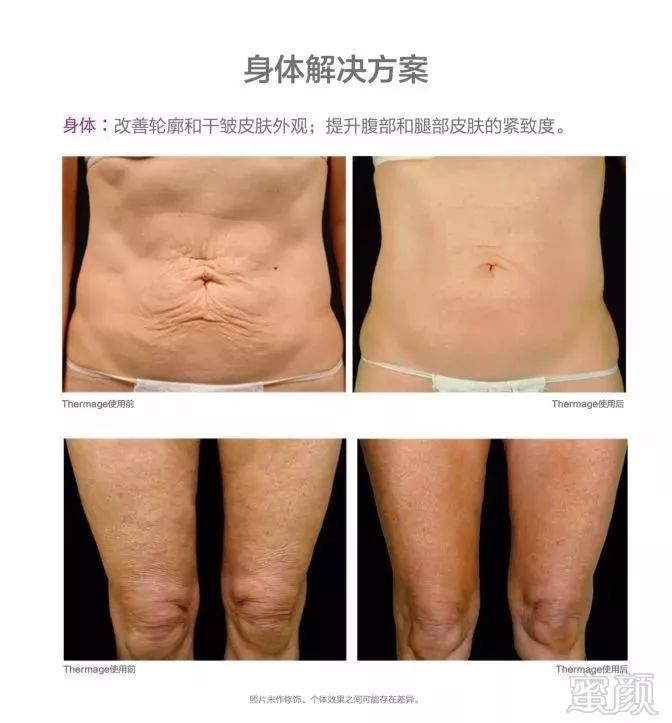 https://img.miyanlife.com/mnt/timg/191108/10510139D-9.jpg