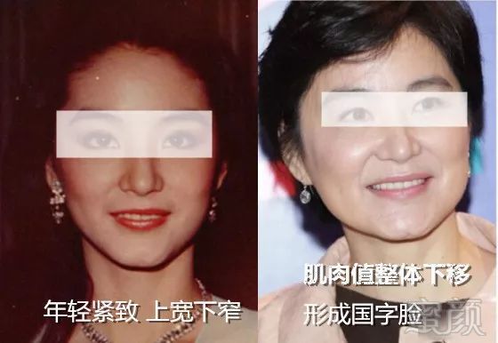 https://img.miyanlife.com/mnt/timg/191108/10532912A-1.jpg