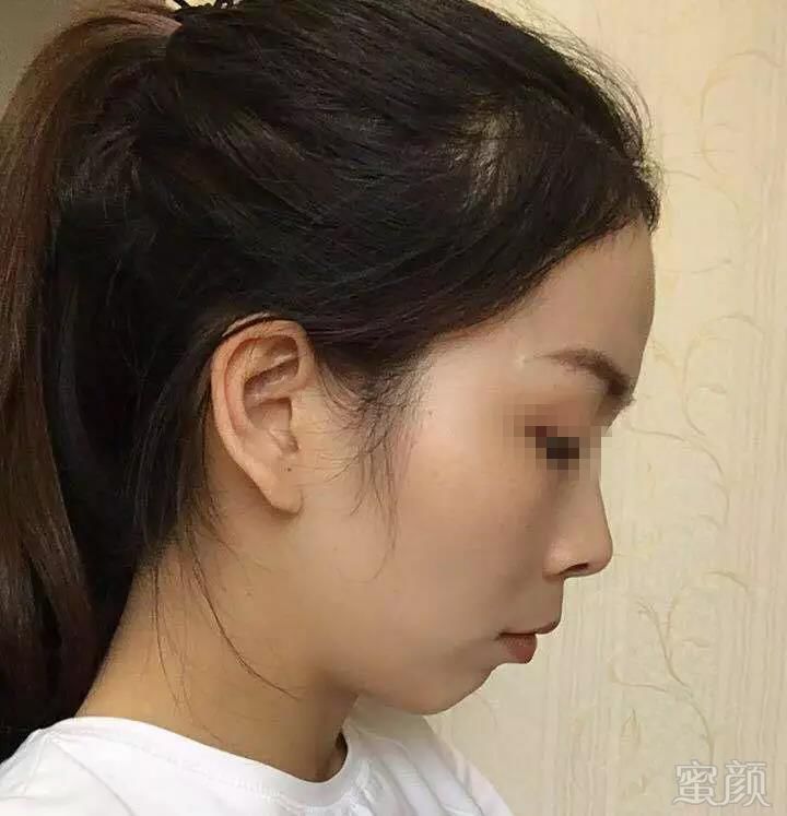 https://img.miyanlife.com/mnt/timg/191109/1111146230-16.jpg