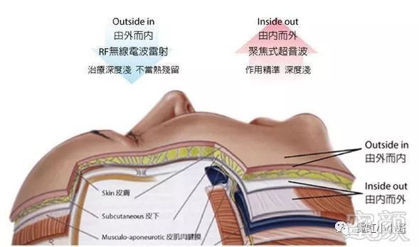 https://img.miyanlife.com/mnt/timg/191109/13050630J-5.jpg