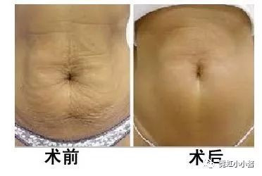 https://img.miyanlife.com/mnt/timg/191109/1305121013-15.jpg