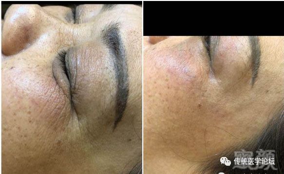 https://img.miyanlife.com/mnt/timg/191113/125100L17-1.jpg