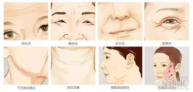 https://img.miyanlife.com/mnt/timg/191113/125102H17-4.jpg