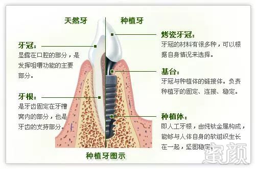 案例图片