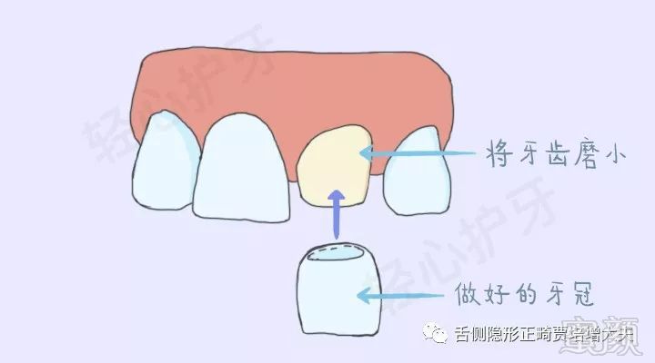 案例图片