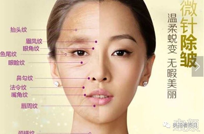 https://img.miyanlife.com/mnt/timg/191121/125F0A24-1.jpg